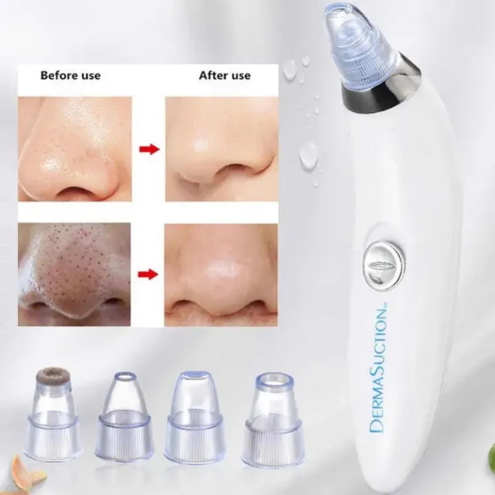Nose hair removal device with before and after effects on skin, and additional attachments displayed.