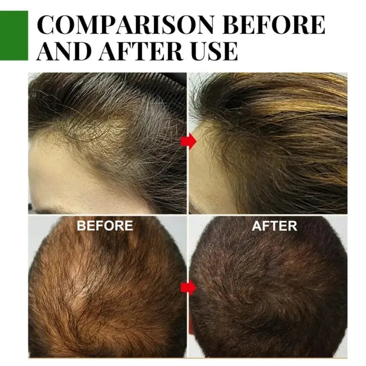 Rosemary Hair Growth Essential Oil – Anti Hair Fall Treatment, Scalp Nourishing & Thickening Oil for Strong, Healthy Hair (UAE)