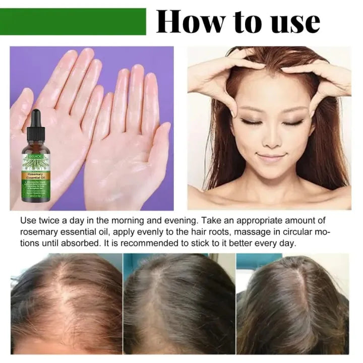 Rosemary Hair Growth Essential Oil – Anti Hair Fall Treatment, Scalp Nourishing & Thickening Oil for Strong, Healthy Hair (UAE)