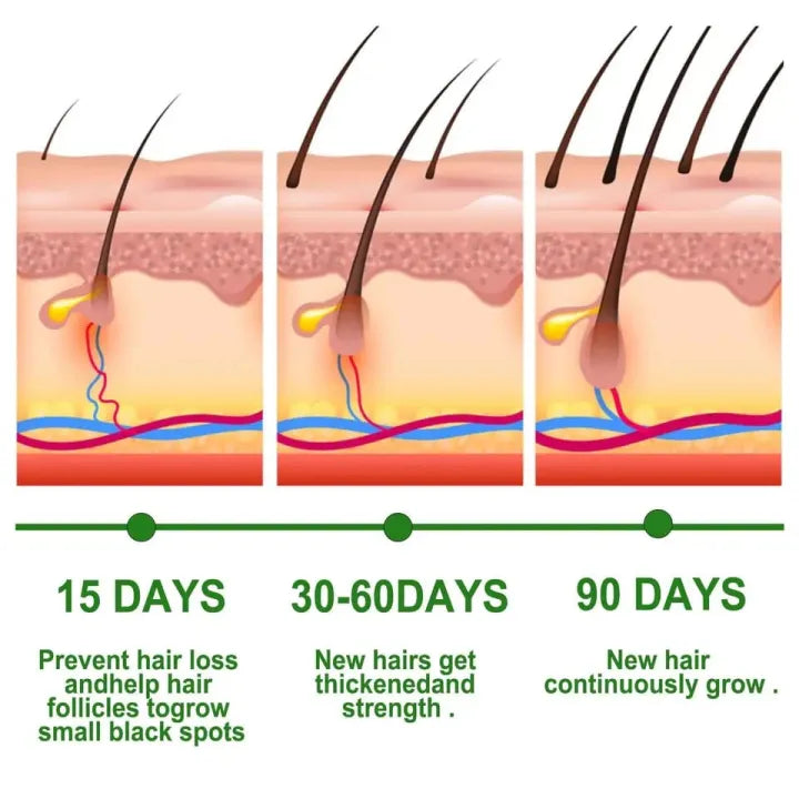 Rosemary Hair Growth Essential Oil – Anti Hair Fall Treatment, Scalp Nourishing & Thickening Oil for Strong, Healthy Hair (UAE)