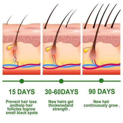 Rosemary Hair Growth Essential Oil – Anti Hair Fall Treatment, Scalp Nourishing & Thickening Oil for Strong, Healthy Hair (UAE)