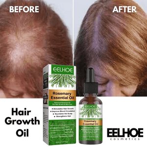 Rosemary Hair Growth Essential Oil – Anti Hair Fall Treatment, Scalp Nourishing & Thickening Oil for Strong, Healthy Hair (UAE)
