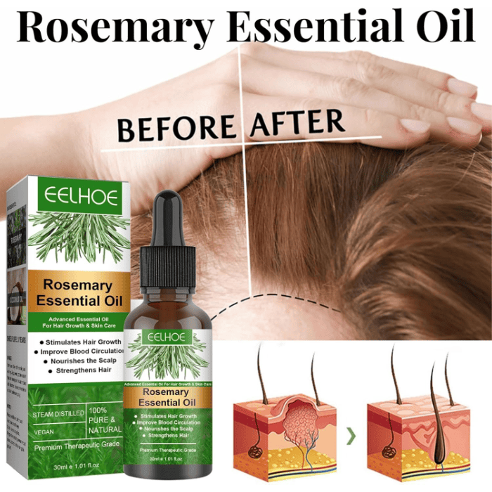 Rosemary Hair Growth Essential Oil – Anti Hair Fall Treatment, Scalp Nourishing & Thickening Oil for Strong, Healthy Hair (UAE)