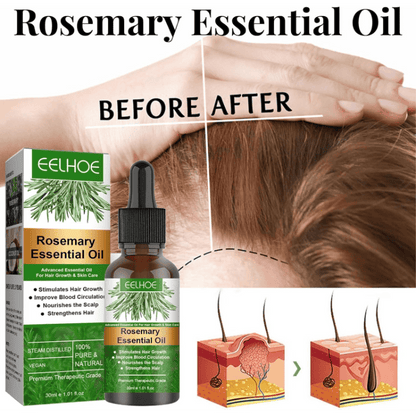 Rosemary Hair Growth Essential Oil – Anti Hair Fall Treatment, Scalp Nourishing & Thickening Oil for Strong, Healthy Hair (UAE)